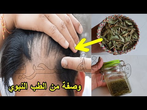 علاج تساقط الشعر - معالجة تساقط الشعر 0 2