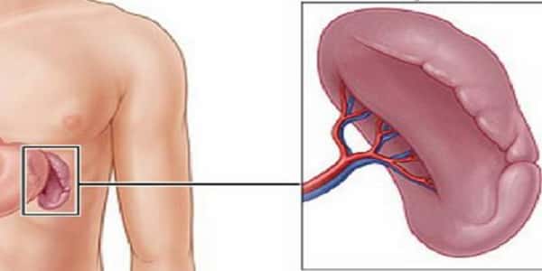 علاج تضخم الطحال - كيف نعالج تضحم الطحال بسهولة 12298 3