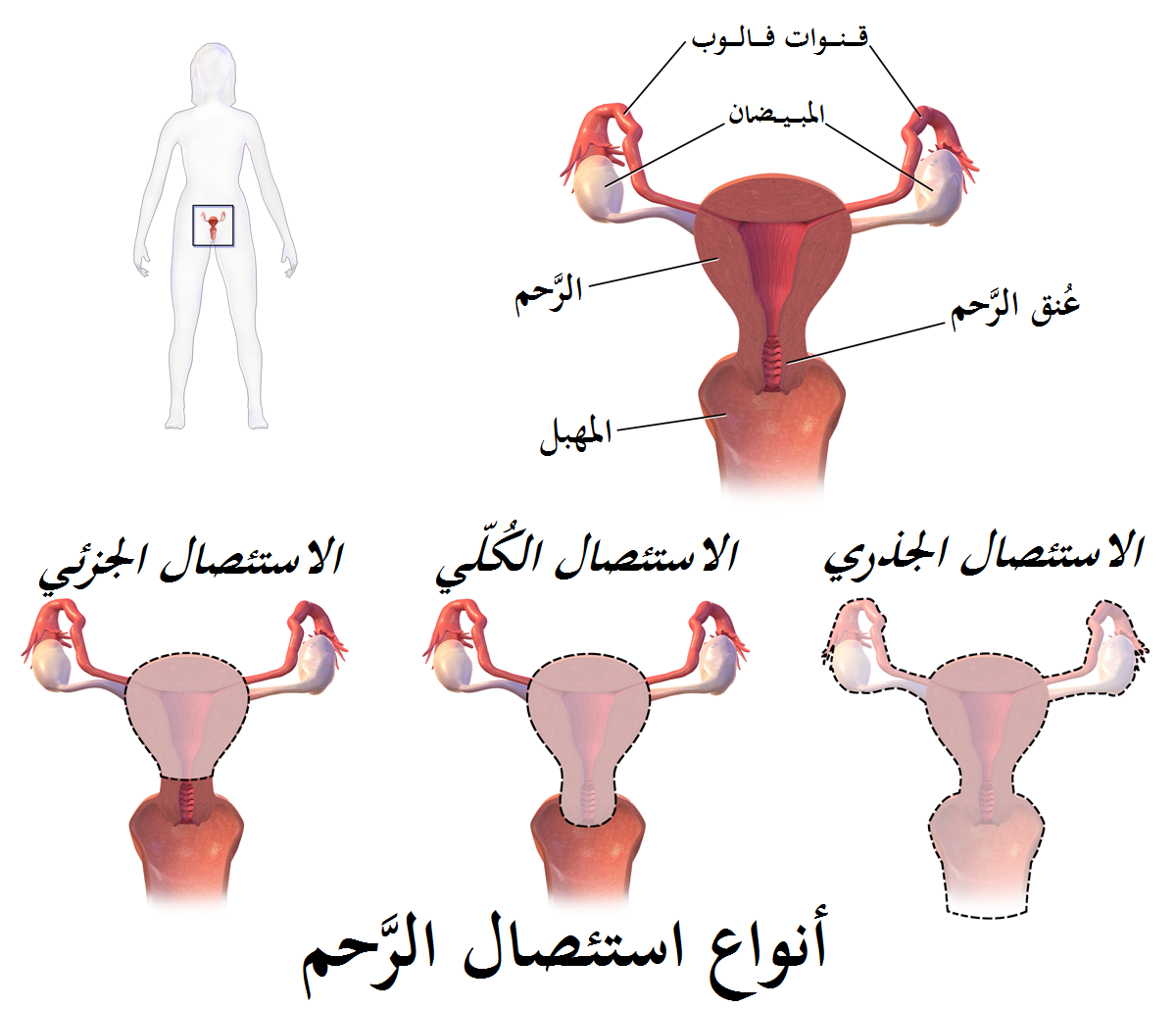 الرحم بعد الولادة بالصور , ماذا يحدث في الداخل