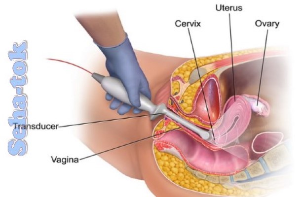 عمليات تجميل المهبل بالصور قبل وبعد - عمليات تجميل للمهبل 4096 5