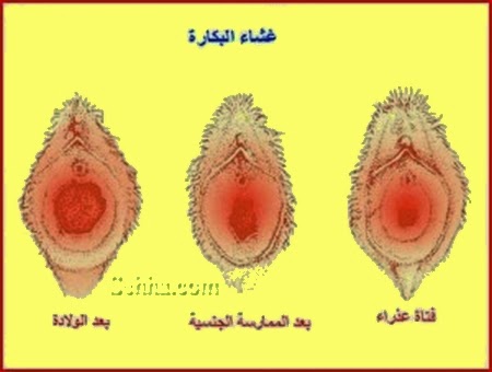 كيفيه معرفه البنت العذراء بالصور , كشف العذوريه