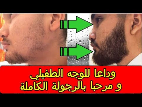 انبات شعر الذقن بالثوم - فوايد التوم عديدة ومهمة تعالو نشوف بنعمل ايه بالتوم 13032 1