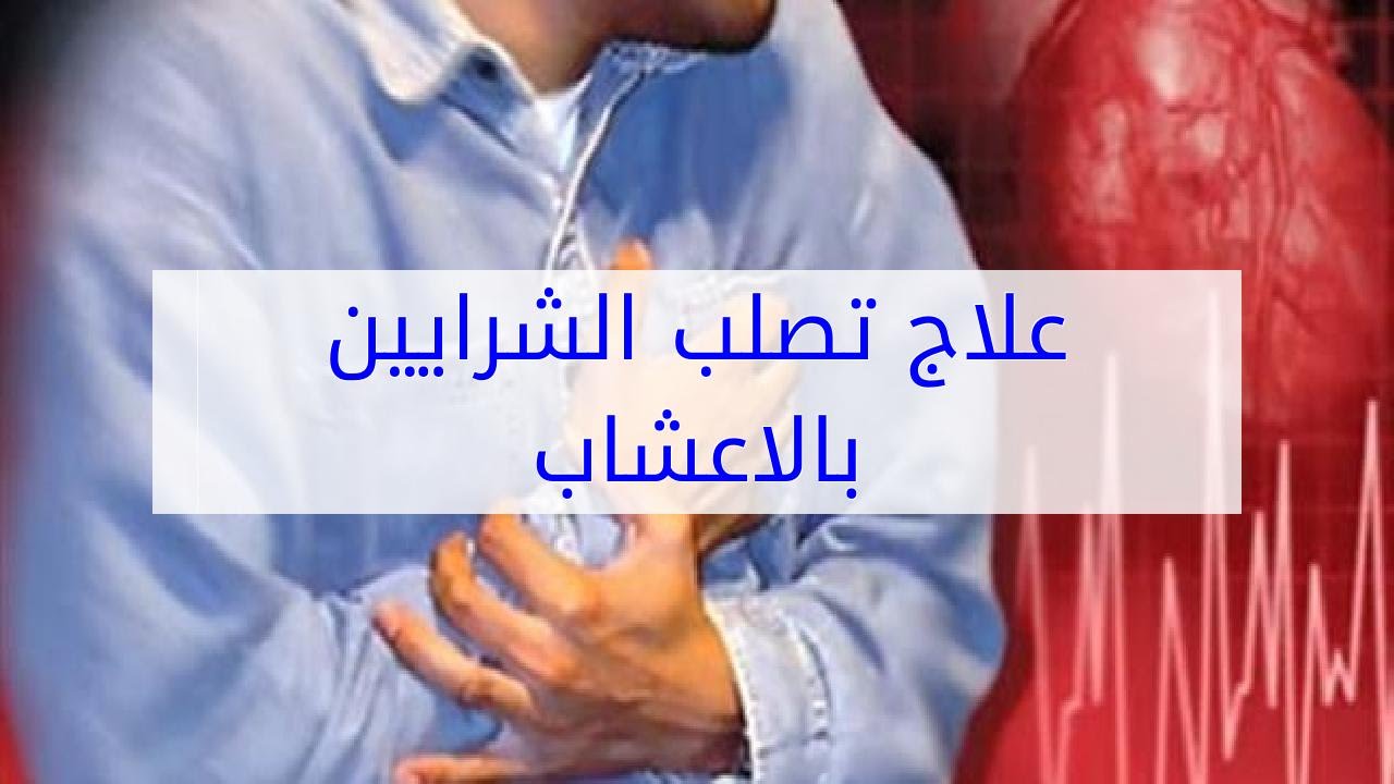 علاج تصلب الشرايين , افضل علاج مرض تصلب او انسداد الشرايين