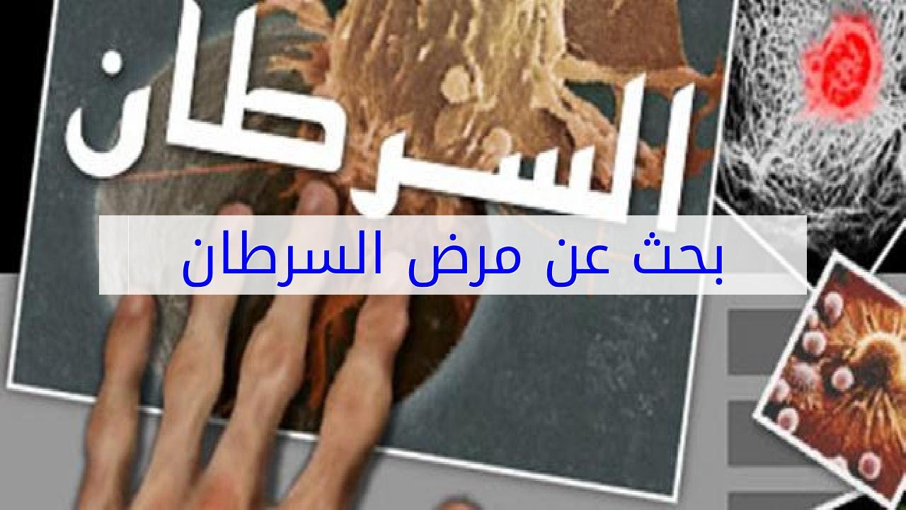 بحث حول مرض السرطان 12837 1