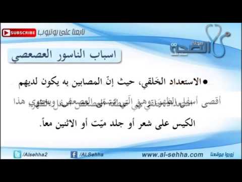 مرض الناسور - اسباب وطرق علاج مرض الناسور 0 57