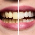 652 3 كيفية تبييض الاسنان - اروع الوصفات الطبيعيه لاسنان بيضاء مايا عاتكة